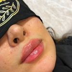 کلینیک تخصصی پوست مو و لیزر اوا