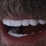 مرکز دندانپزشکی ایمپلنت ژنیک