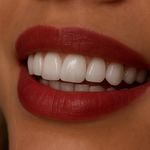 کلینیک‌دندانپزشکی دنتال آرنا-بیمه نیستیم