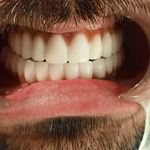 دندانپزشکی ایمپلنت و کلیه خدمات