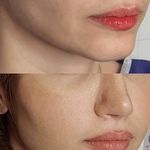 کلینیک زیبایی الماس کاملا اقساطی