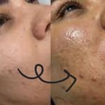 خدمات تخصصی پاکسازی پوست و فیشال نگاره