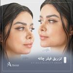 مجموعه زیبایی آتی‌ماه