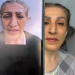 مطب پوست و مو و لیزر ژیوان