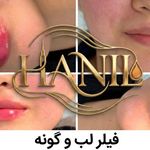 کلینیک هانیل | فیلر و بوتاکس شرق