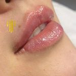 کلینیک پوست،زیبایی ولیزر اِلی(کندلا2025)