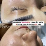Skincare _eliamini