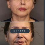 کلینیک پوست و مو موتاکس ملکی