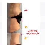 کلینیک تغذیه و رژیم درمانی و تناسب اندام (دکتر هانیه روانبخش)