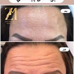 کلینیک پوست،مو و لیزر زینا مختاری