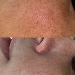 خدمات تخصصی پوست،فیشال،ماساژ سندی بانوان