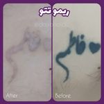 کلینیک لیزر و زیبایی دایان