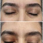 اصلاح تخصصی وترمیمی ابروی فرزانه