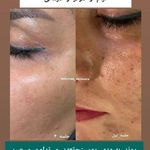 خدمات فیشال پاکسازی/اسکالپ اسکراپ ماهرخ