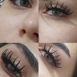 کاشت مژه موقت و دائم
