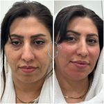 مطب لیزر و زیبایی گلها(سانا اسکین سابق)