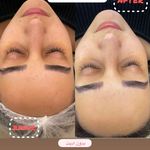 خدمات فیشیال و پاکسازی پوست
