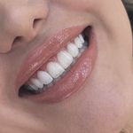 دندانپزشکی دکتر المیرا پویان فر
