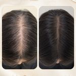 کلینیک زیبایی و مرکز لیزر هانیسا