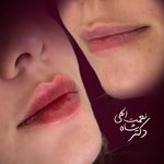 پوست مو فیلر جوانساز دکتر شاه نعمت الهی