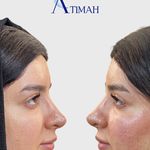 مجموعه زیبایی آتیماه