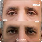 کلینیک پوست مو و زیبایی نوین ایرانا