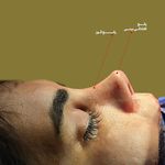 کلینیک زیبایی در سعادت آباد