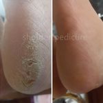 پدیکورتخصصی شهره