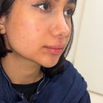 کلینیک تخصصی ژل و بوتاکس مرضیه آقابابایی