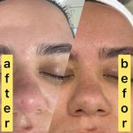 خدمات تخصصی پوست (فیشیالیست رویا صالحی)