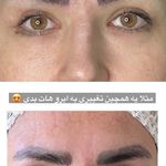 کلینیک زیبایی اویسا پوست،مو،زیبایی  لیزر