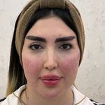 کلینیک پوست سلین - کلینیک پوست و مو - شهر شیراز - 0030