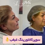 کلینیک تخصصی زیبایی و لیزر موی ابریشم