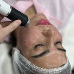 فشیال و پاکسازی پوست مهشید