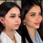 کلینیک ژل بوتاکس لیزر فیل بیوتی