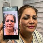 مطب پوست و مو و لیزر ژیوان