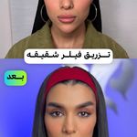 کلینیک تخصصی زیبایی نیوفیس