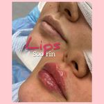 کلینیک زیبایی و پوست دکتر سورین