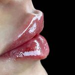 کلینیک جراحی سوپرکانتورینگ غبغب وی لاین