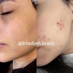 کلینیک زیبایی دکتر هدیه دهقانپور
