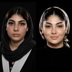 کلینیک ژل بوتاکس لیزر فیل بیوتی