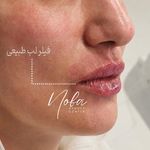 کلینیک زیبایی و لیزر مو زائد نوبا