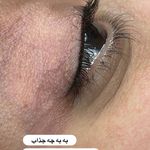 میکروکیماسی( میکروابرو چشم لب،ریمو)