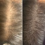 Lilac Spa | مرکز تخصصی پوست و مو