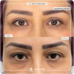 کلینیک پوست مو و زیبایی نوین ایرانا