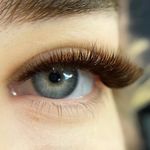 کاشت مژه رشت