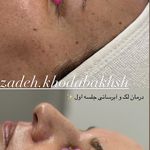 مطب زیبایی آرا