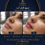 کلینیک زیبایی دریا/دکتر امیر قهرمانی