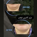 کلینیک زیبایی لاغری لیزر دانا