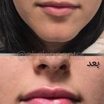 مطب زیبایی دکتر ملکی
